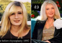 ,,ქალს აქვს უფლება, არ იყოს ლამაზი, მაგრამ არ აქვს უფლება, არ უყვარდეს საკუთარი თავი” – როგორ გამოიყურებოდა ნინო ნადირაძე რინოპლასტიკამდე