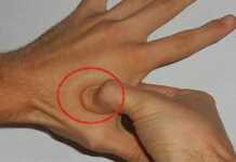 მკურნალობის არამედიკამენტოზური გზები: თუ ცერა თითზე თითს დაიჭერთ, დიდ პრობლემას მოიხსნით – ეს ყველამ უნდა იცოდეს!