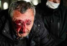 კაცმა, რომელმაც აქციაზე ცალ თვალში მხედველობა დაკარგა, კლინიკა ოპერაციისთვის 800 ლარს სთხოვს