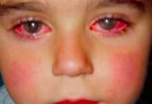 ბიჭმა მხედველობის 75% დაკარგა იმ სათამაშოს გამო, რომელიც უამრავ ბავშვს აქვს! ის რაც აუცილებლად ყველა მშობელმა უნდა იცოდეს