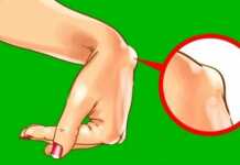 სასწრაფოდ შეამოწმეთ გაქვთ თუ არა მაჯაზე ასეთი ამობურცული!