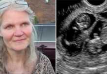 ქალი 42 წლის ასაკში ტყუპებს (სამეულს) ელოდებოდა: მშობიარობისას ექიმი შოკირებული დარჩა (ფოტოები)