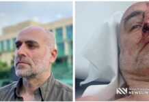 “დასრულდა ოპერაცია, მადლობა ექიმებს უმაღლესი დონის პროფესიონალიზმისთვის” – როგორია დავით ქაცარავას ჯანმრთელობის მდგომარეობა