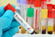 ასპინძასა და ნინოწმინდაში ბრუცელოზის შემთხვევები გამოვლინდა