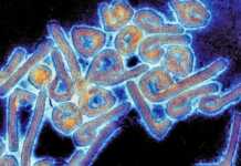 მარბურგის ახალი ვირუსით დაინფიცირებული 26 შემთხვევიდან 8 ფატალურად დასრულდა – რის გამოც ჰამბურგში რკინიგზის სადგური დაიკეტა